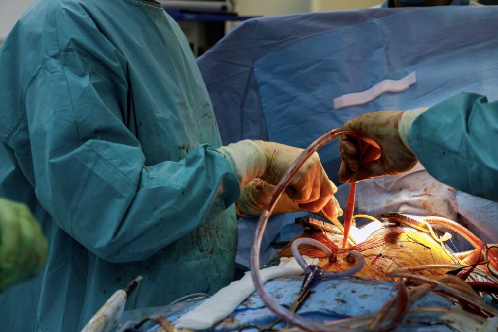 Minimally invasive cardiac surgery in Kanpur with Dr Saeed Akhtar.